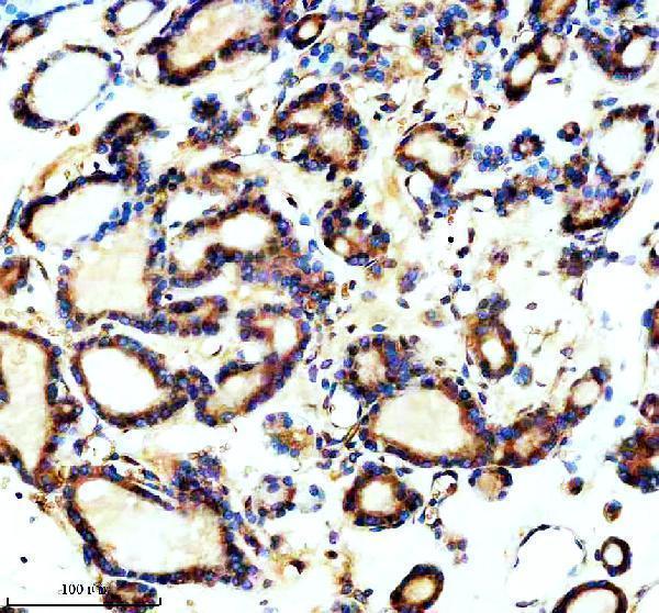 IHC analysis of TCTN1 using anti-TCTN1 antibody (A09350-1)
