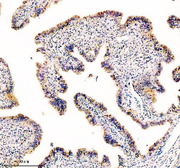 IHC analysis of TCTN1 using anti-TCTN1 antibody (A09350-1)