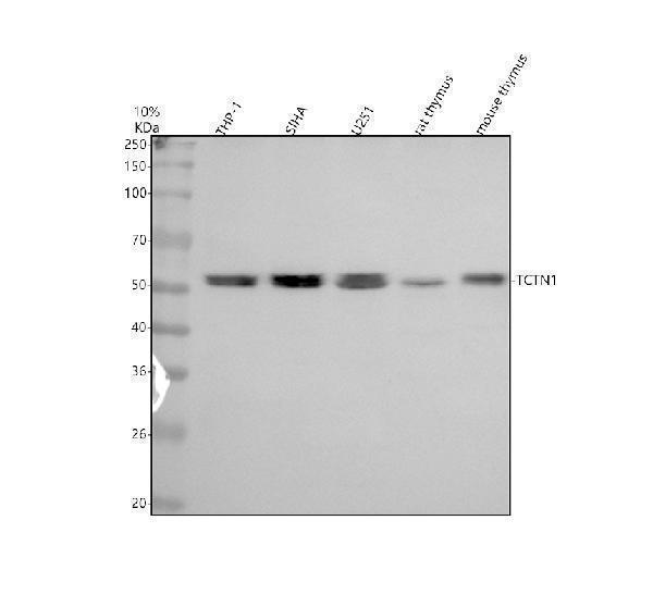 Western blot analysis of TCTN1 using anti-TCTN1 antibody (A09350-1)
