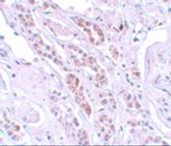 a09350 tctn1 primary antibodies ihc testing 2