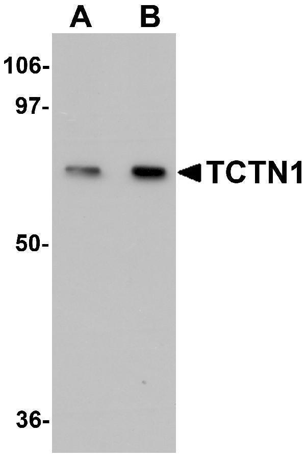 a09350 tctn1 primary antibodies wb testing 1