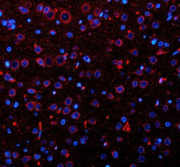 a09353 3 opn3 primary antibodies if testing 2