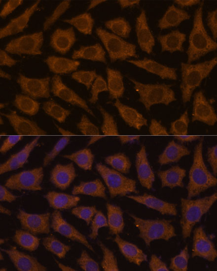 a09354 mtmr4 primary antiboties if testing 2