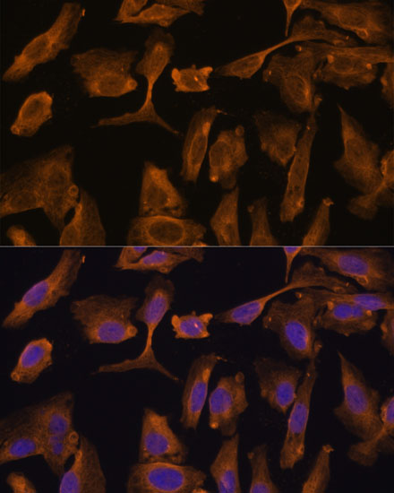 a09354 mtmr4 primary antiboties if testing 3