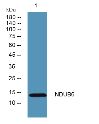 Western blot analysis of lysates from PC12 cells, primary antibody was diluted at 1:1000, 4°over night