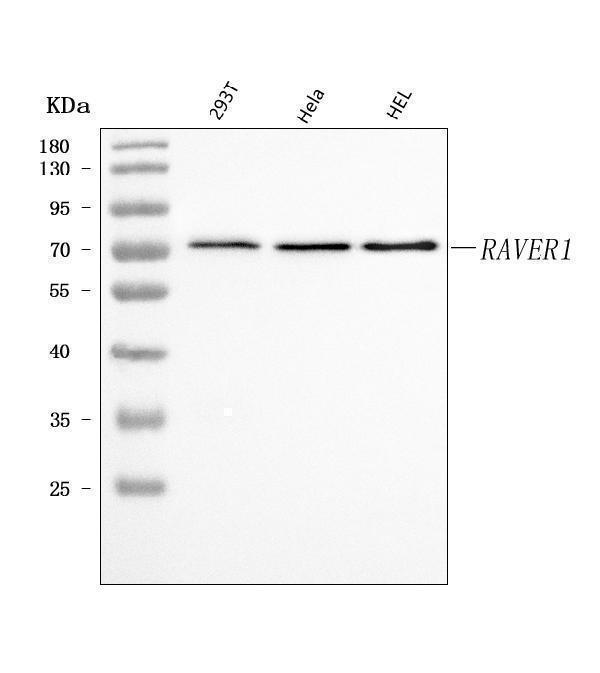  Western blot analysis of RAVER1 using anti-RAVER1 antibody (A09359-2)