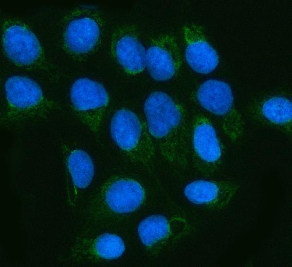 a09360 1 mgme1 primary antibodies if testing 5