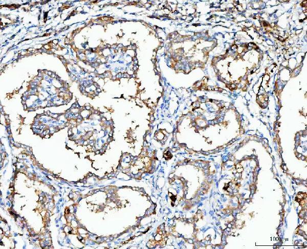 a09360 1 mgme1 primary antibodies ihc testing 2