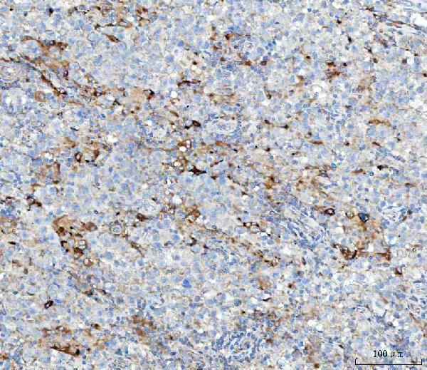 a09360 1 mgme1 primary antibodies ihc testing 4