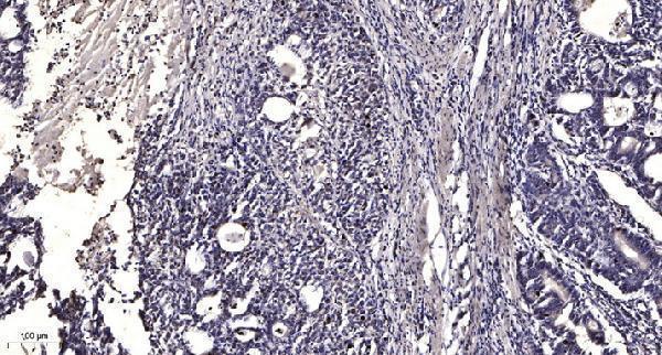 a09361 mchr2 primary antibodies ihc testing 1