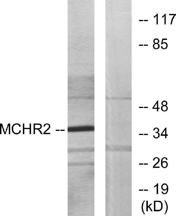 a09361 mchr2 primary antibodies wb testing 2