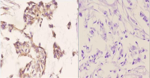 a09363 scgb2a2 primary antiboties ihc testing 2