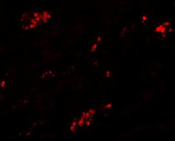 a09364 tmem59 primary antibodies if testing 3