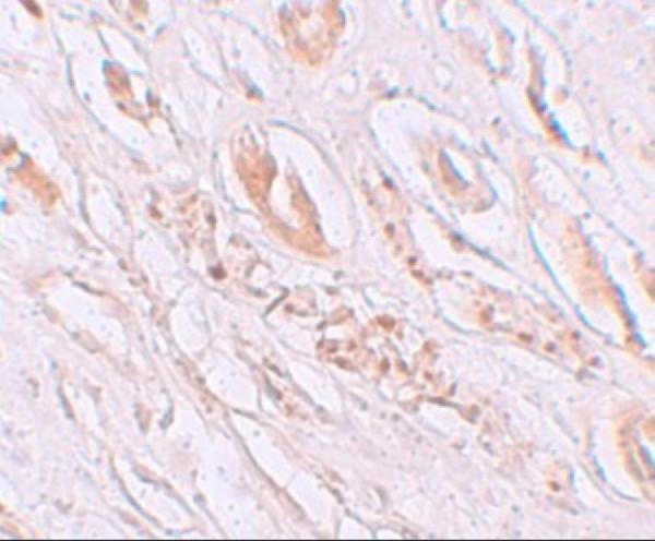 a09364 tmem59 primary antibodies ihc testing 2