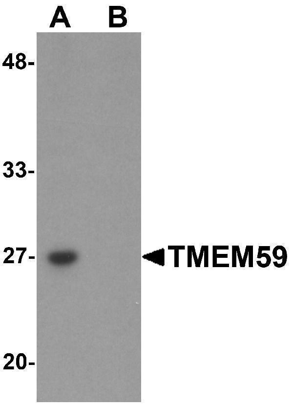 a09364 tmem59 primary antibodies wb testing 1