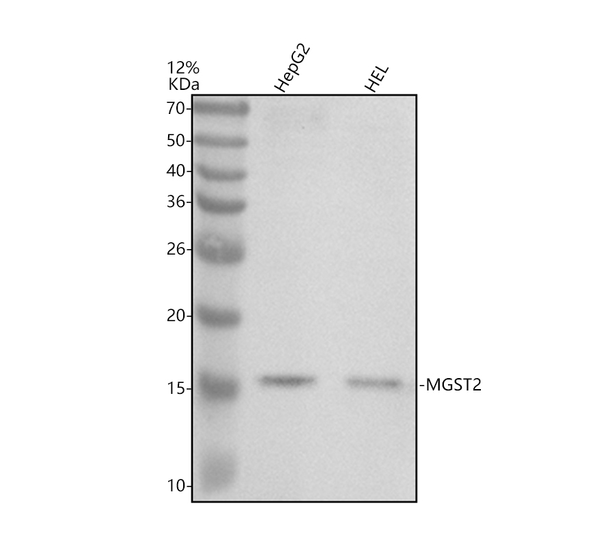 Western blot analysis of MGST2 using anti-MGST2 antibody (A09366-1)