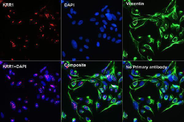 a09368 krr1 primary antiboties if testing 3