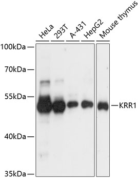 a09368 krr1 primary antiboties wb testing 1