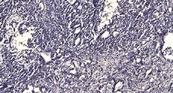 a09369 1 agpat3 primary antibodies ihc testing 1