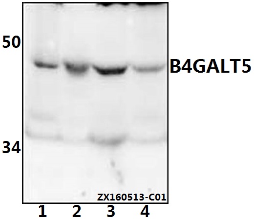 Western blot (WB) analysis of B4GALT5 polyclonal antibody at 1:500 dilution
Lane1:786-O whole cell lysate(40ug)
Lane2:HEK293T whole cell lysate(40ug)
Lane3:The kidney tissue lysate of Mouse(40ug)
Lane4:The kidney tissue lysate of Rat(40ug)