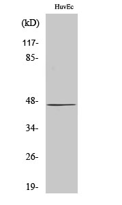 Western Blot analysis of 293 cells using β-1, 4-Gal-T5 Polyclonal Antibody diluted at 1:1000