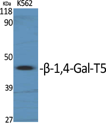 Western Blot analysis of various cells using β-1, 4-Gal-T5 Polyclonal Antibody diluted at 1:1000