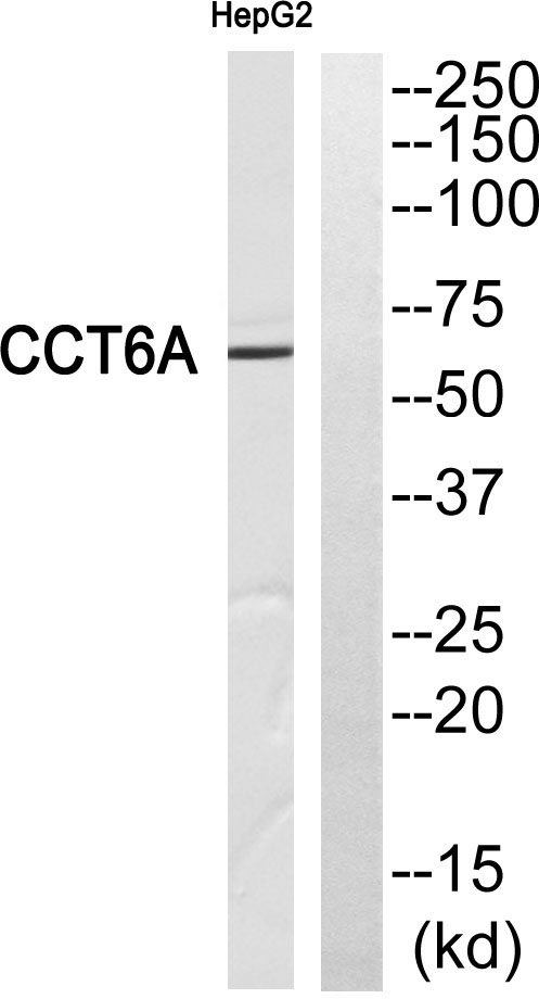 Western blot analysis of CCT6A Antibody
