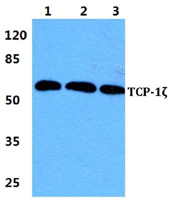 Western blot (WB) analysis of TCP-1ζ polyclonal antibody at 1:500 dilution
Lane1:Hela cell lysate
Lane2:sp2/0 cell lysate
Lane3:PC12 cell lysate