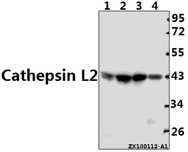 Western blot (WB) analysis of Cathepsin L2 (L114) pAb at 1:1000 dilution
Lane1:The Testis tissue lysate of Mouse(40ug)
Lane2:The Testis tissue lysate of Rat(40ug)
Lane3:L02 whole cell lysate(20ug)
Lane4:A375 whole cell lysate(20ug)