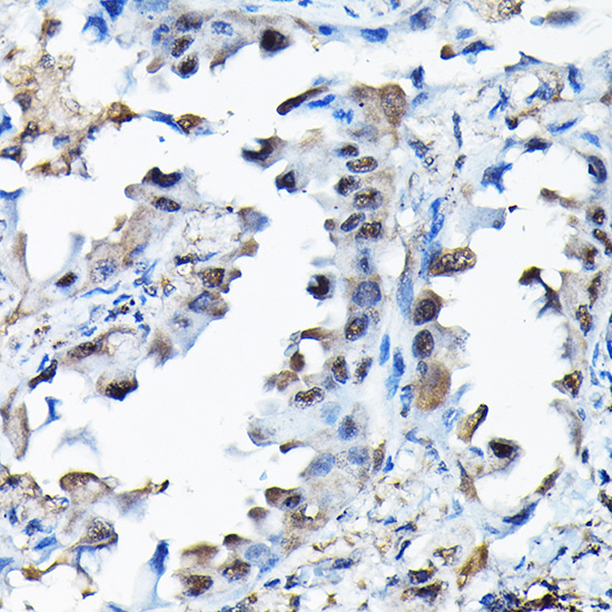a09378 rbbp9 primary antiboties ihc testing 4