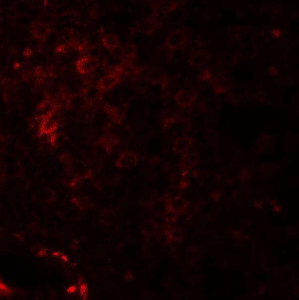 a09381 1 nkx2 6 primary antibodies if testing 3