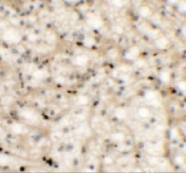 a09381 1 nkx2 6 primary antibodies ihc testing 2