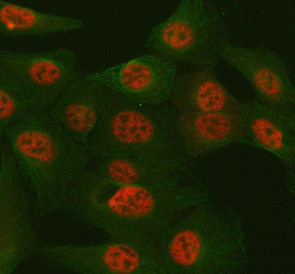 IF analysis of TULP3 using anti-TULP3 antibody (A09384-2) and anti-Tubulin Alpha antibody (M03989-3)