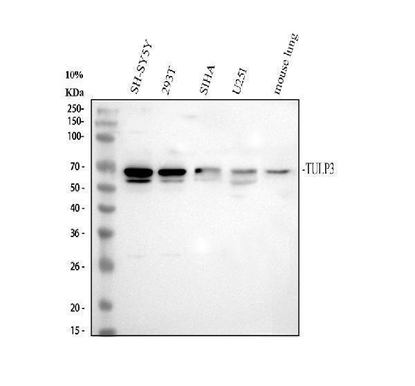 Western blot analysis of TULP3 using anti-TULP3 antibody (A09384-2)
