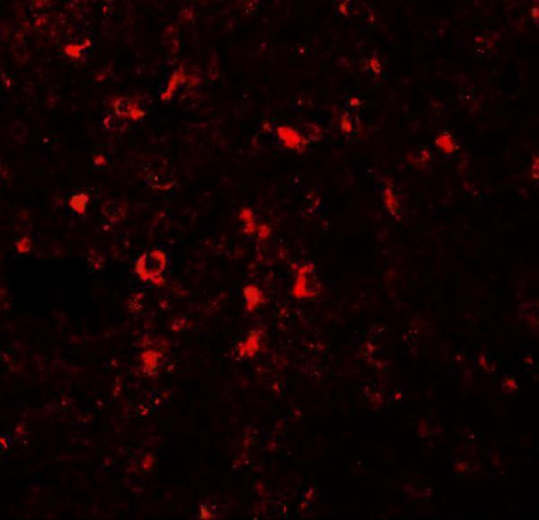 Immunofluorescence of ZIP5 in human spleen tissue with ZIP5 antibody at 20 μg/mL