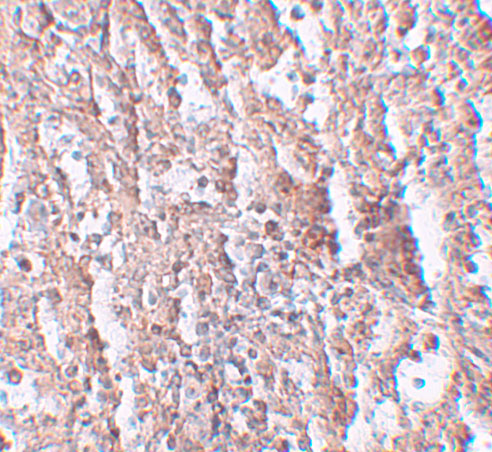 Immunohistochemistry of ZIP5 in human spleen tissue with ZIP5 antibody at 2