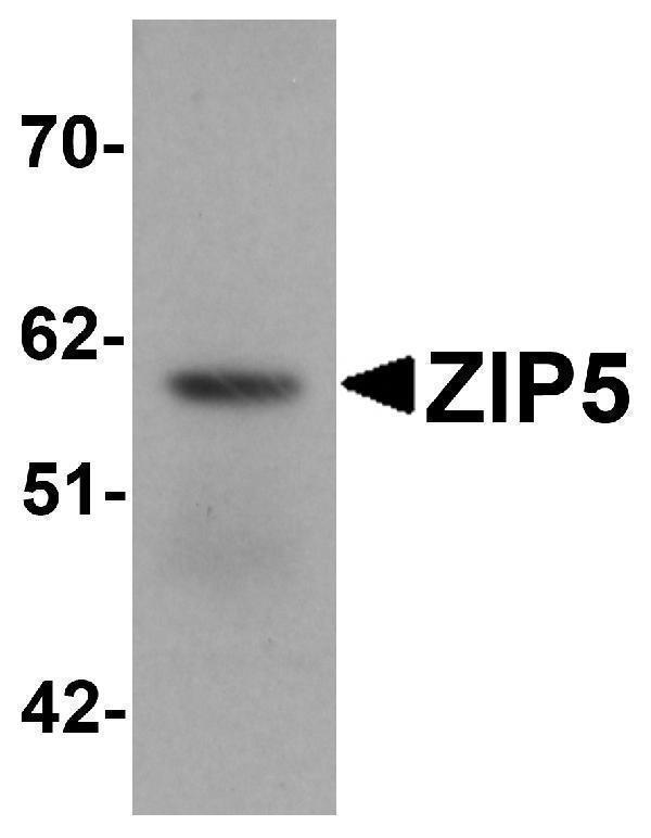 Western blot analysis of ZIP5 in human spleen tissue lysate with ZIP5 antibody at 1 μg/mL