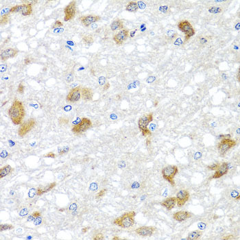 Immunohistochemistry of paraffin-embedded rat brain using PIP4K2B antibody at dilution of 1:100 (x40 lens)