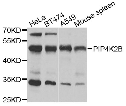 Western blot analysis of extracts of various cells, using PIP4K2B antibody