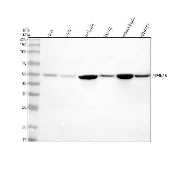  Western blot analysis of PIP4K2B using anti-PIP4K2B antibody (A09390-2)