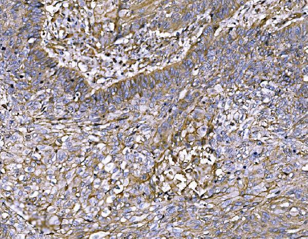  IHC analysis of FAM129B/NIBAN2 using anti-FAM129B/NIBAN2 antibody (A09391-2)