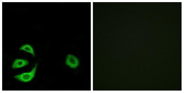 a09392 1 acot8 primary antibodies if testing 1