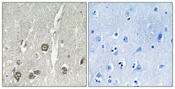 Immunohistochemical analysis of paraffin-embedded Human brain