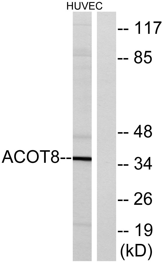 Western blot analysis of lysates from HUVEC cells, using ACOT8 Antibody