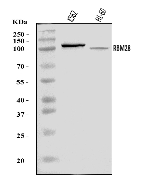  Western blot analysis of RBM28 using anti-RBM28 antibody (A09394-1)