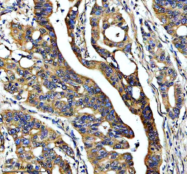 IHC analysis of LXN using anti-LXN antibody (A09395-1)