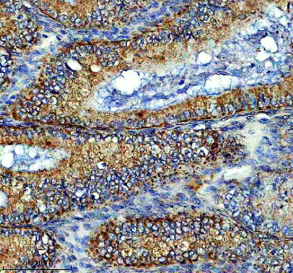 IHC analysis of LXN using anti-LXN antibody (A09395-1)