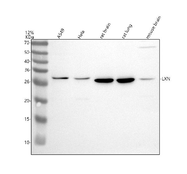 Western blot analysis of LXN using anti-LXN antibody (A09395-1)
