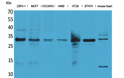 Western Blot analysis of 22RV-1, MCF7, OVCAR3, H460, HT29, BT474, mouse heart cells using Latexin Polyclonal Antibody