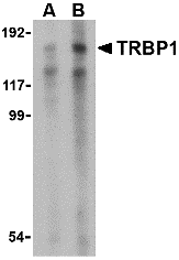 Western blot analysis of TRBP1 in 3T3 cell lysate with TRBP1 antibody at (A) 1 and (B) 2 μg/mL